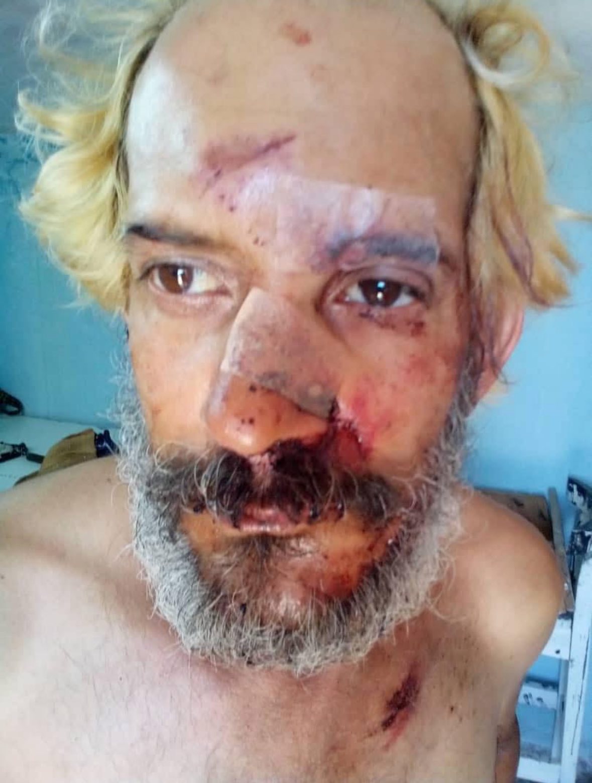 La violencia que no cesa: Brutal golpiza a músico cubano en La Habana La violencia que no cesa: Brutal golpiza a músico cubano en La Habana